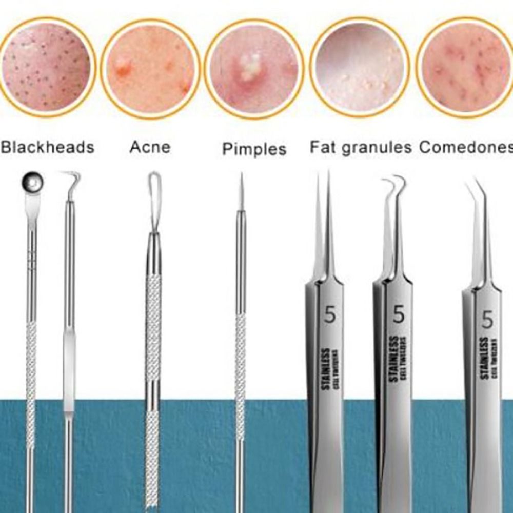 Kit de ferramentas para extração facial com pontas finas e alças curvadas