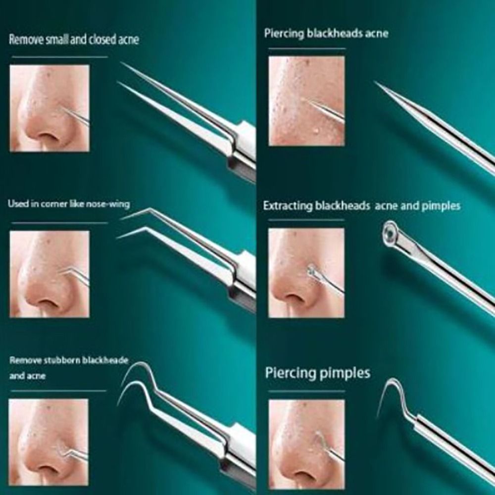 Ferramentas de acne em uso no rosto, com pontas para perfuração e extração